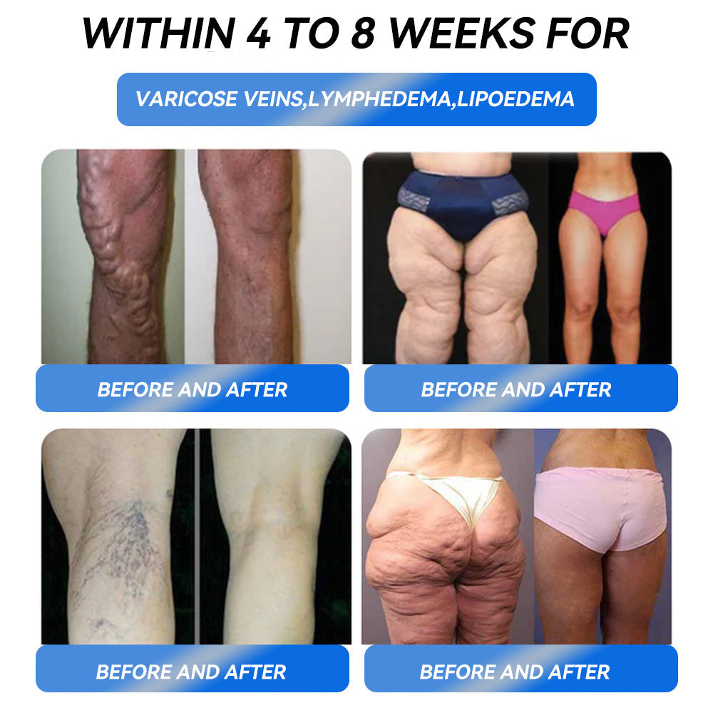 IFMAGIC® GLP-1 Pro Weight Loss Oral Solution✅Recommended doctors for obesity in the USA👩⚕️Suitable for obesity, cardiovascular diseases, diabetes, sleep apnea, high cholesterol and blood lipids, joint problems, and various other conditions👍