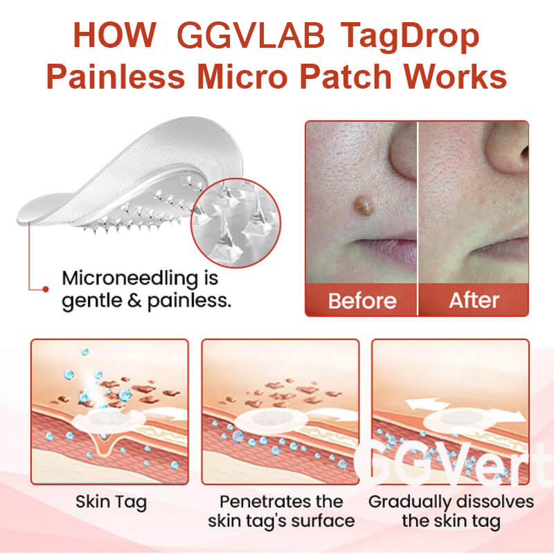 đ„painless micro-patchđ„
