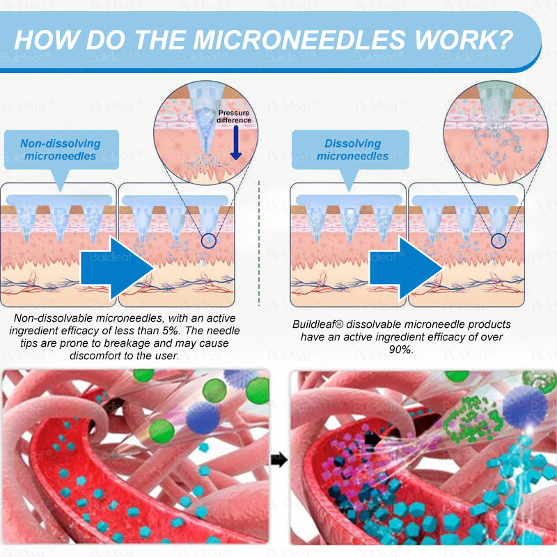 ๐๐FDA Official Store๐๐| ๐ต๐ข๐๐๐๐๐๐๐ยฎ GLP-1 Nano-Microneedle Patch with Collagen & ๐๐๐ก๐๐๐ฅ๐ฆ๐ 3000 ไธจ๐๐๐๐๐๐ก๐ ๐๐๐๐ ๐๐ก๐ฆ, ๐ฟ๐๐๐ ๐ ๐๐๐๐, ๐ป๐๐โ ๐ต๐๐๐๐ ๐๐๐๐ ๐ ๐ข๐๐, ๐ท๐๐๐๐๐ก๐๐ , ๐น๐๐ก๐ก๐ฆ ๐ฟ๐๐ฃ๐๐, ๐ฝ๐๐๐๐ก ๐๐๐๐, ๐ต๐๐๐๐ ๐น๐๐, ๐ฟ๐๐ค ๐ธ๐๐๐๐๐ฆ, ๐ต๐๐๐ฆ ๐ด๐โ๐๐ , ๐๐๐ ๐๐๐๐