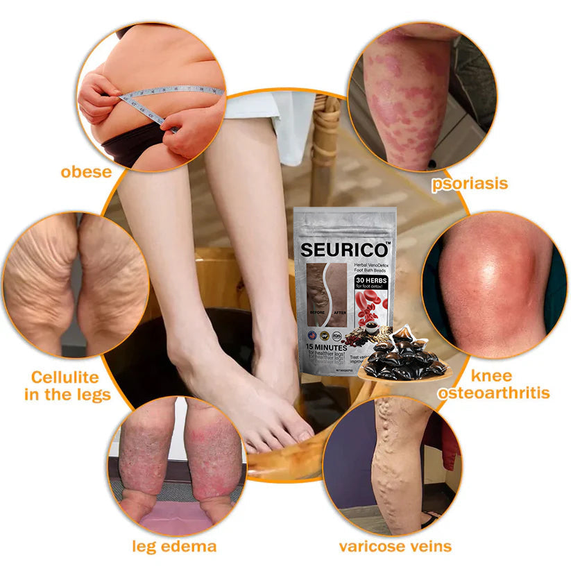 Seurico™ Herbal VenoDetox Foot Bath Beads🌲(𝐋𝐀𝐍𝐀 𝐂𝐞𝐫𝐭𝐢𝐟𝐢𝐜𝐚𝐭𝐢𝐨𝐧,𝗟𝘆𝗺𝗽𝗵𝗮𝘁𝗶𝗰 𝗔𝘀𝘀𝗼𝗰𝗶𝗮𝘁𝗶𝗼𝗻 𝗼𝗳 𝗔𝗺𝗲𝗿𝗶𝗰𝗮)