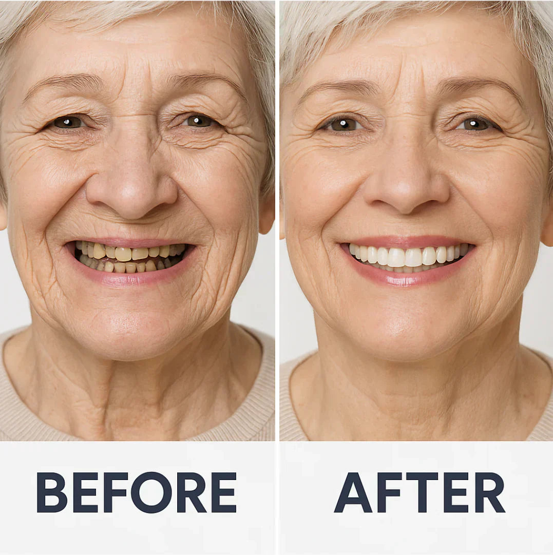 𦷠NESLEMY⢠Custom-Fit Functional Dentures š Smile with Confidence