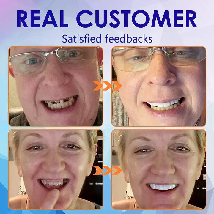 NESLEMYâ˘-đڎAdvanced Customized Full Denture Set𦷠(â°Limited time discount last 30 minutesâ°)
