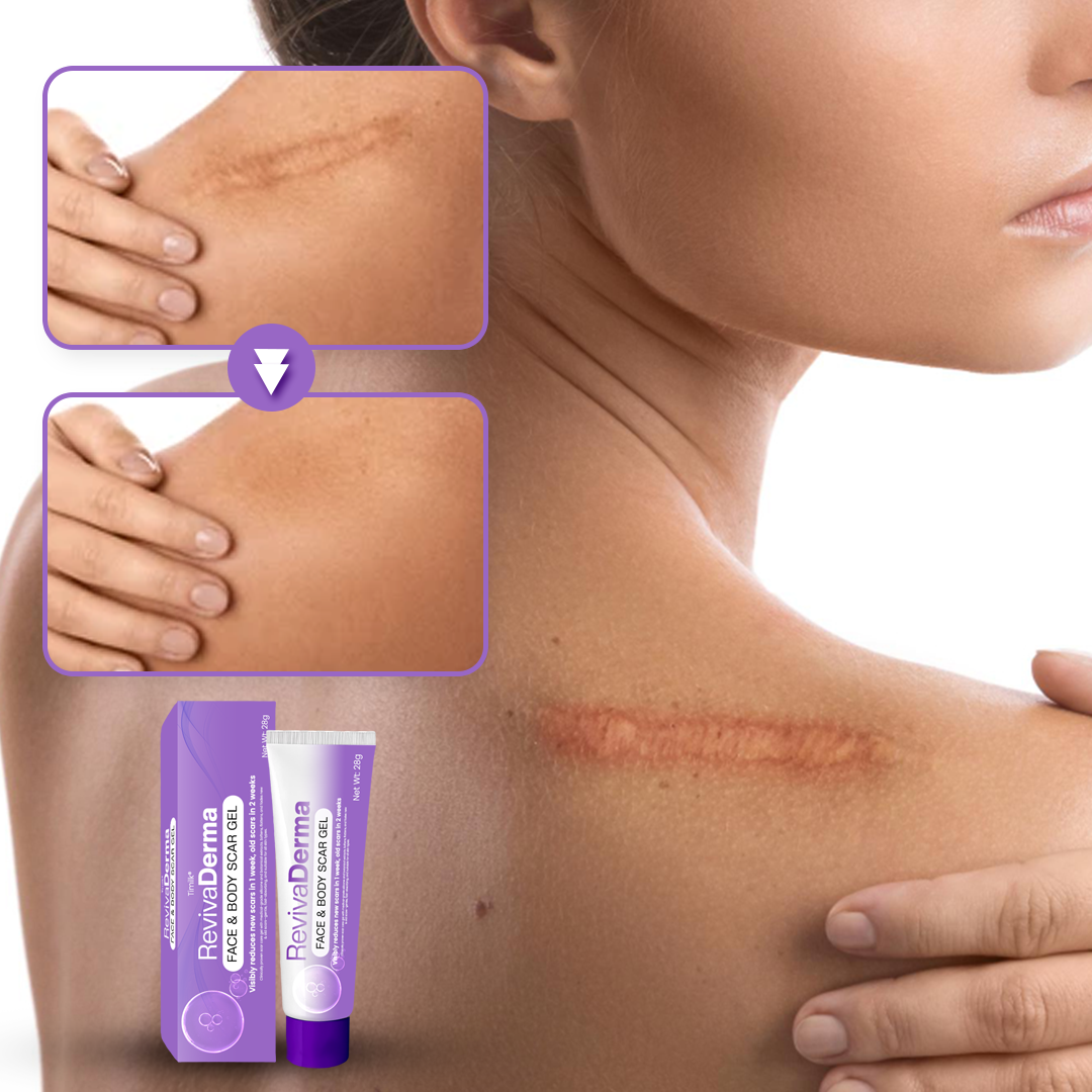Timilk® RevivaDerma Face & Body Scar Gel - Clinically proven to soften, flatten and fade surgical scars, acne marks, burns, keloids and trauma-related scars