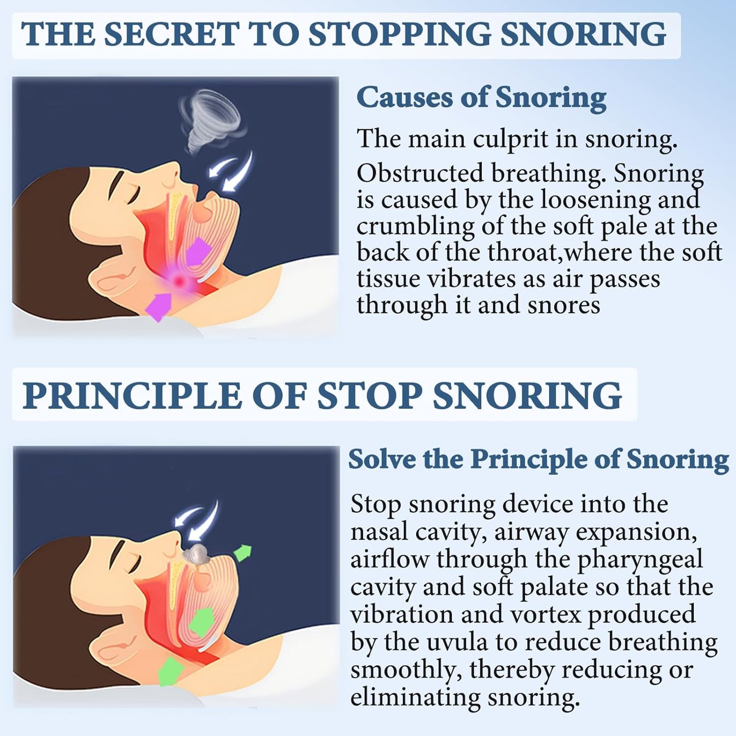 SleepEase Mouthguard