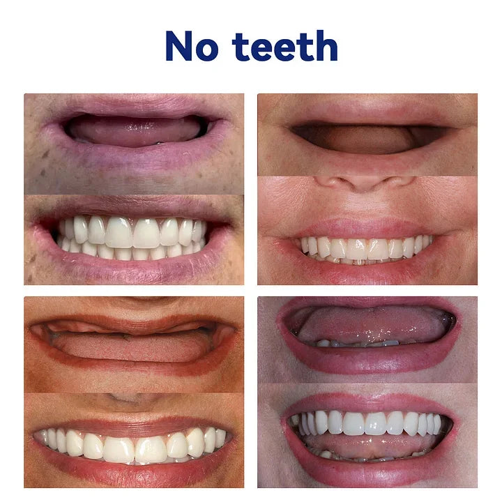 NESLEMYâ˘-đڎAdvanced Customized Full Denture Set𦷠(â°Limited time discount last 30 minutesâ°)