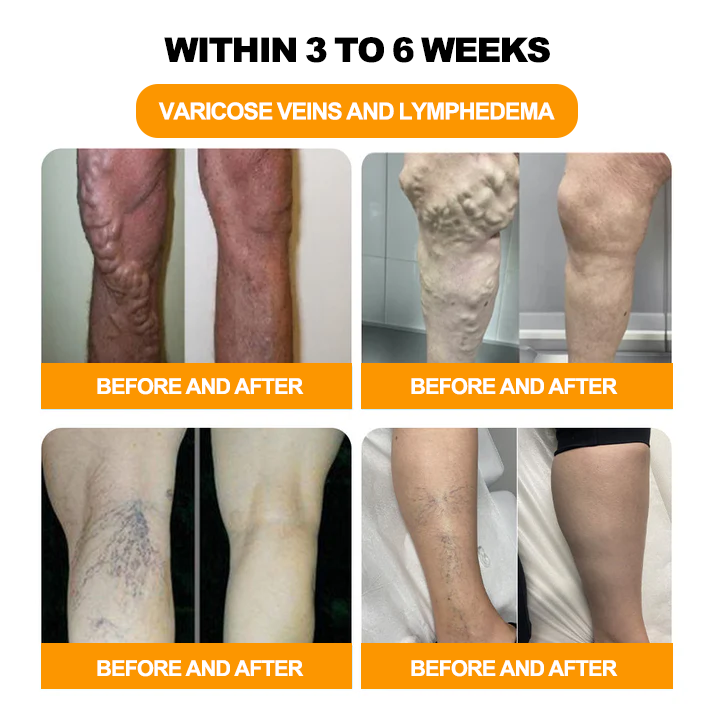 Seurico™ Herbal VenoDetox Foot Bath Beads🌲(𝐋𝐀𝐍𝐀 𝐂𝐞𝐫𝐭𝐢𝐟𝐢𝐜𝐚𝐭𝐢𝐨𝐧,𝗟𝘆𝗺𝗽𝗵𝗮𝘁𝗶𝗰 𝗔𝘀𝘀𝗼𝗰𝗶𝗮𝘁𝗶𝗼𝗻 𝗼𝗳 𝗔𝗺𝗲𝗿𝗶𝗰𝗮)