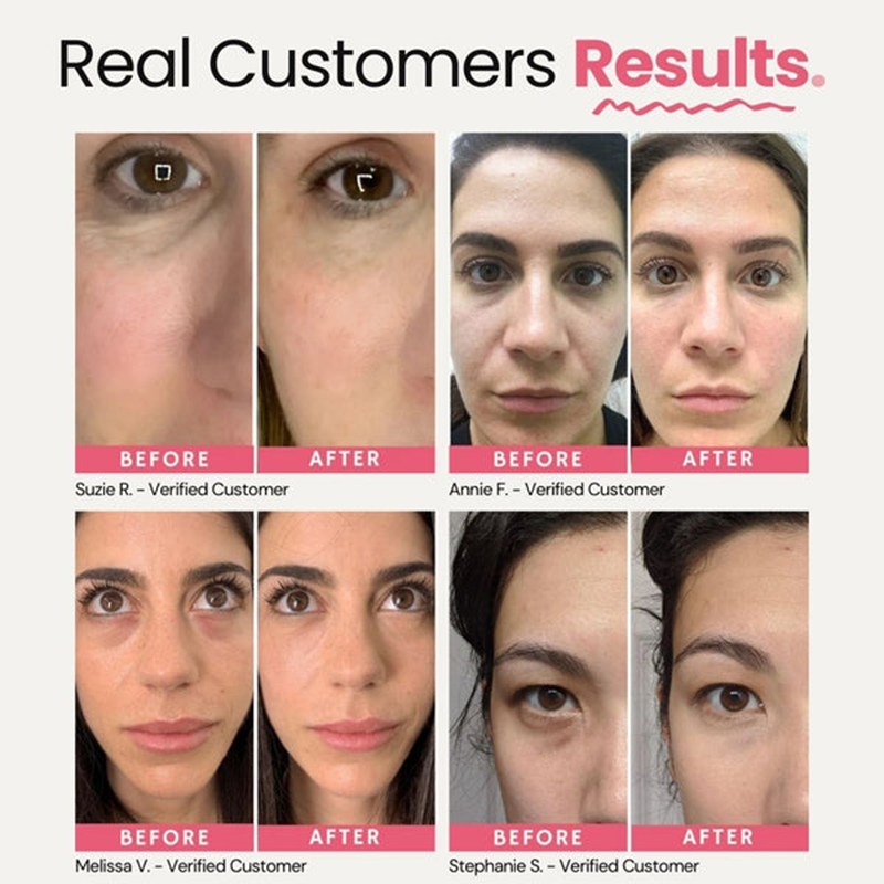 Under Eye Brightener