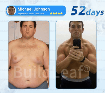 ✅FDA Store |𝐵uil𝗱𝐿ea𝐟® 𝑮𝐋𝑃-1 Slim & Firm 𝑁ano 𝑀icroneedle 𝑃atch with Collagen,Turmeric&Matrixyl 3000 丨Obesity,Cardiovascular Diseas, Diabetes, Sleep Apnea, Joint Problems and More