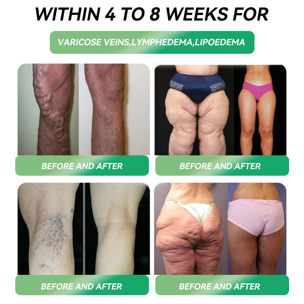 | 𝐎𝐟𝐟𝐢𝐜𝐢𝐚𝐥 𝐒𝐭𝐨𝐫𝐞 |✅𝐏𝐄𝐀𝐊𝐀® 𝐆𝐋𝐏-𝟏 𝐖𝐞𝐢𝐠𝐡𝐭 𝐋𝐨𝐬𝐬 𝐎𝐫𝐚𝐥 𝐒𝐨𝐥𝐮𝐭𝐢𝐨𝐧 - 👨‍⚕️ 𝐎𝐛𝐞𝐬𝐢𝐭𝐲,𝐂𝐚𝐫𝐝𝐢𝐨𝐯𝐚𝐬𝐜𝐮𝐥𝐚𝐫 𝐃𝐢𝐬𝐞𝐚𝐬, 𝐃𝐢𝐚𝐛𝐞𝐭𝐞𝐬, 𝐒𝐥𝐞𝐞𝐩 𝐀𝐩𝐧𝐞𝐚, 𝐉𝐨𝐢𝐧𝐭 𝐏𝐫𝐨𝐛𝐥𝐞𝐦𝐬 𝐚𝐧𝐝 𝐌𝐨𝐫𝐞