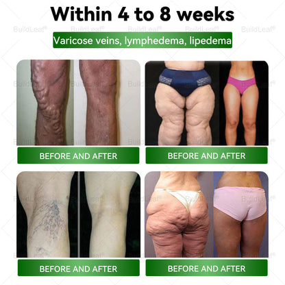 𝐁𝐮𝐢𝐥𝐝𝐋𝐞𝐚𝐟® 💎𝐓𝐢𝐫𝐳𝐞𝐩𝐚𝐭𝐢𝐝𝐞 𝐆𝐋𝐏-𝟏 𝐇𝐞𝐫𝐛𝐚𝐥 𝐎𝐫𝐚𝐥 𝐋𝐢𝐪𝐮𝐢𝐝 |  𝐎𝐛𝐞𝐬𝐢𝐭𝐲, 𝐋𝐲𝐦𝐩𝐡𝐞𝐝𝐞𝐦𝐚, 𝐃𝐢𝐚𝐛𝐞𝐭𝐞𝐬, 𝐂𝐚𝐫𝐝𝐢𝐨𝐯𝐚𝐬𝐜𝐮𝐥𝐚𝐫 𝐝𝐢𝐬𝐞𝐚𝐬𝐞, 𝐇𝐢𝐠𝐡 𝐛𝐥𝐨𝐨𝐝 𝐩𝐫𝐞𝐬𝐬𝐮𝐫𝐞, 𝐅𝐚𝐭𝐭𝐲 𝐥𝐢𝐯𝐞𝐫, 𝐚𝐧𝐝 𝐆𝐮𝐭 𝐡𝐞𝐚𝐥𝐭𝐡 𝐢𝐬𝐬𝐮𝐞𝐬