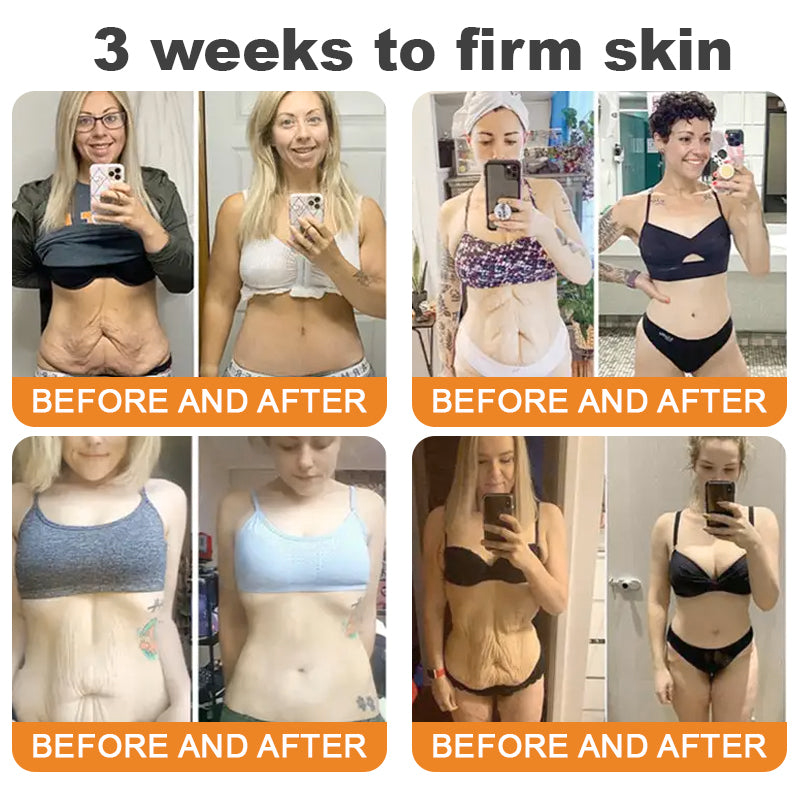 ✨𝐓𝐮𝐫𝐨𝐧𝐮® 𝐁𝐞𝐞 𝐕𝐞𝐧𝐨𝐦 𝐌𝐮𝐥𝐭𝐢-𝐂𝐚𝐫𝐞 𝐒𝐤𝐢𝐧 𝐑𝐞𝐩𝐚𝐢𝐫 𝐂𝐫𝐞𝐚𝐦 [See visible firming in just 7 days! ✔ Backed by our 180-day money-back guarantee🔥]