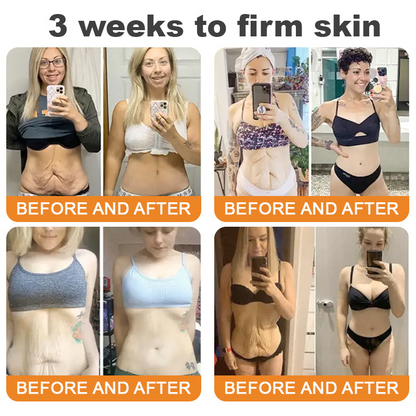 ✨𝐓𝐮𝐫𝐨𝐧𝐮® 𝐁𝐞𝐞 𝐕𝐞𝐧𝐨𝐦 𝐌𝐮𝐥𝐭𝐢-𝐂𝐚𝐫𝐞 𝐒𝐤𝐢𝐧 𝐑𝐞𝐩𝐚𝐢𝐫 𝐂𝐫𝐞𝐚𝐦 [See visible firming in just 7 days! ✔ Backed by our 180-day money-back guarantee🔥]