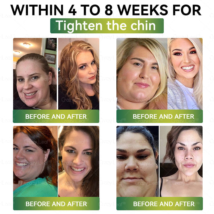 CrazyLeaf® GLP-1 Weight Loss Oral Solution – 👨‍⚕️ Supports Relief from Obesity, Cardiovascular Disease, Diabetes, Sleep Apnea, Joint Problems, and More 3