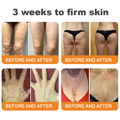 ✨𝐓𝐮𝐫𝐨𝐧𝐮® 𝐁𝐞𝐞 𝐕𝐞𝐧𝐨𝐦 𝐌𝐮𝐥𝐭𝐢-𝐂𝐚𝐫𝐞 𝐒𝐤𝐢𝐧 𝐑𝐞𝐩𝐚𝐢𝐫 𝐂𝐫𝐞𝐚𝐦 [See visible firming in just 7 days! ✔ Backed by our 180-day money-back guarantee🔥]