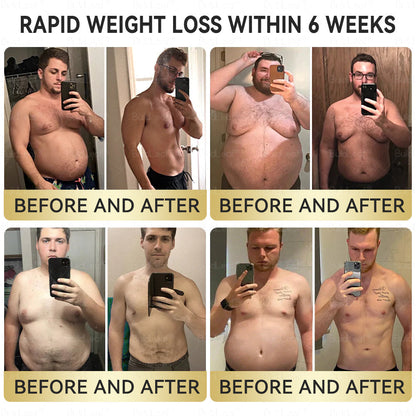 ✅ FDA-Approved | BuildLeaf® Tirzepatide GLP-1 Slimming & Health Boost Drops | GLP-1 Weight Loss Oral Solution Obesity,Cardiovascular Diseas, Diabetes, Sleep Apnea, Joint Problems and More