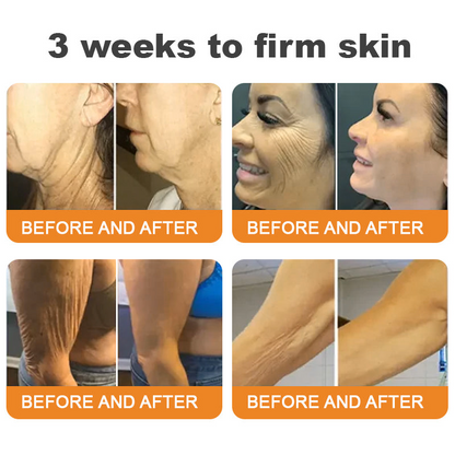 ✨𝐓𝐮𝐫𝐨𝐧𝐮® 𝐁𝐞𝐞 𝐕𝐞𝐧𝐨𝐦 𝐌𝐮𝐥𝐭𝐢-𝐂𝐚𝐫𝐞 𝐒𝐤𝐢𝐧 𝐑𝐞𝐩𝐚𝐢𝐫 𝐂𝐫𝐞𝐚𝐦 [See visible firming in just 7 days! ✔ Backed by our 180-day money-back guarantee🔥]