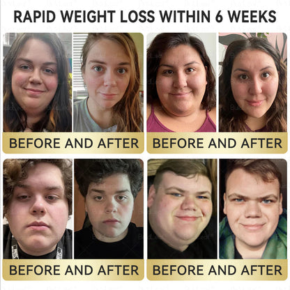 ✅ FDA-Approved | BuildLeaf® Tirzepatide GLP-1 Slimming & Health Boost Drops | GLP-1 Weight Loss Oral Solution Obesity,Cardiovascular Diseas, Diabetes, Sleep Apnea, Joint Problems and More