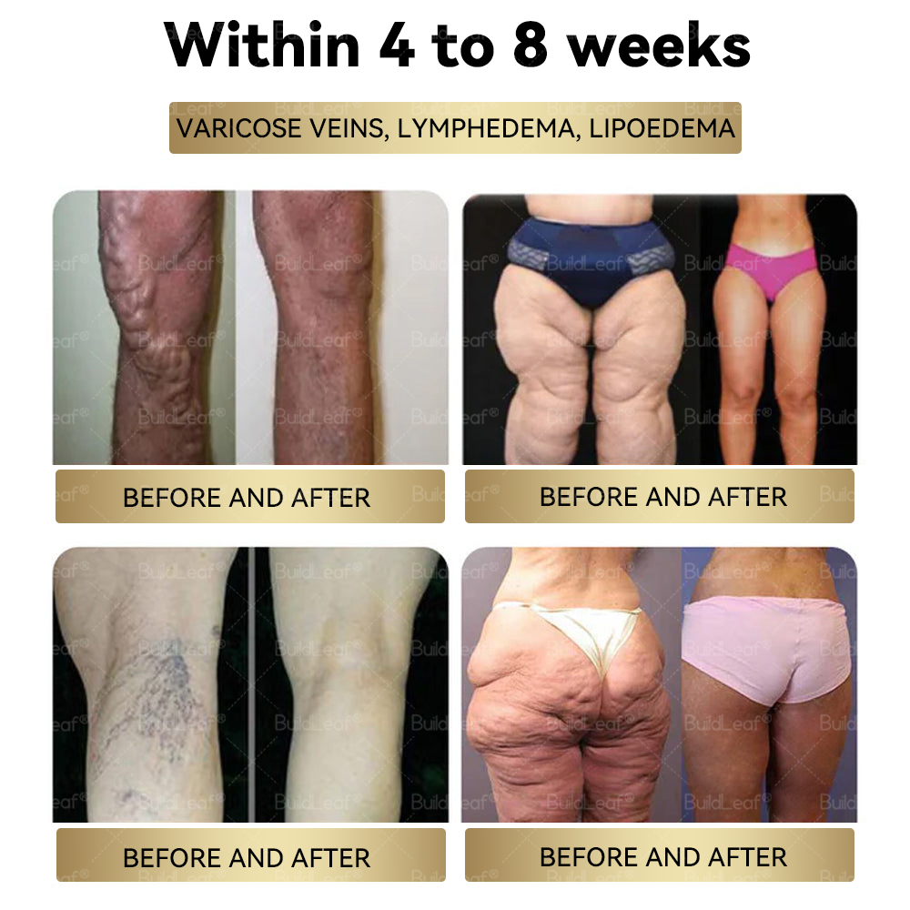 𝑪𝒓𝒂𝒛𝒚𝑳𝒆𝒂𝒇® Tirzepatide 𝗚𝗜𝗣/𝗚𝗟𝗣-𝟭 𝗗𝘂𝗮𝗹-𝗔𝗰𝘁𝗶𝗼𝗻 𝑺𝒍𝒊𝒎𝒎𝒊𝒏𝒈 & 𝑯𝒆𝒂𝒍𝒕𝒉 𝑩𝒐𝒐𝒔𝒕 𝑫𝒓𝒐𝒑𝒔 (𝖥𝗈𝗈𝖽-𝗀𝗋𝖺𝖽𝖾 𝖿𝖺𝗍 𝖻𝗎𝗋𝗇𝖾𝗋 – 𝖣𝖾𝗏𝖾𝗅𝗈𝗉𝖾𝖽 𝖻𝗒 𝖳𝗁𝖾 𝖮𝖻𝖾𝗌𝗂𝗍𝗒 𝖲𝗈𝖼𝗂𝖾𝗍𝗒)