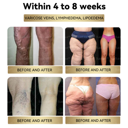 𝑪𝒓𝒂𝒛𝒚𝑳𝒆𝒂𝒇® Tirzepatide 𝗚𝗜𝗣/𝗚𝗟𝗣-𝟭 𝗗𝘂𝗮𝗹-𝗔𝗰𝘁𝗶𝗼𝗻 𝑺𝒍𝒊𝒎𝒎𝒊𝒏𝒈 & 𝑯𝒆𝒂𝒍𝒕𝒉 𝑩𝒐𝒐𝒔𝒕 𝑫𝒓𝒐𝒑𝒔 (𝖥𝗈𝗈𝖽-𝗀𝗋𝖺𝖽𝖾 𝖿𝖺𝗍 𝖻𝗎𝗋𝗇𝖾𝗋 – 𝖣𝖾𝗏𝖾𝗅𝗈𝗉𝖾𝖽 𝖻𝗒 𝖳𝗁𝖾 𝖮𝖻𝖾𝗌𝗂𝗍𝗒 𝖲𝗈𝖼𝗂𝖾𝗍𝗒)
