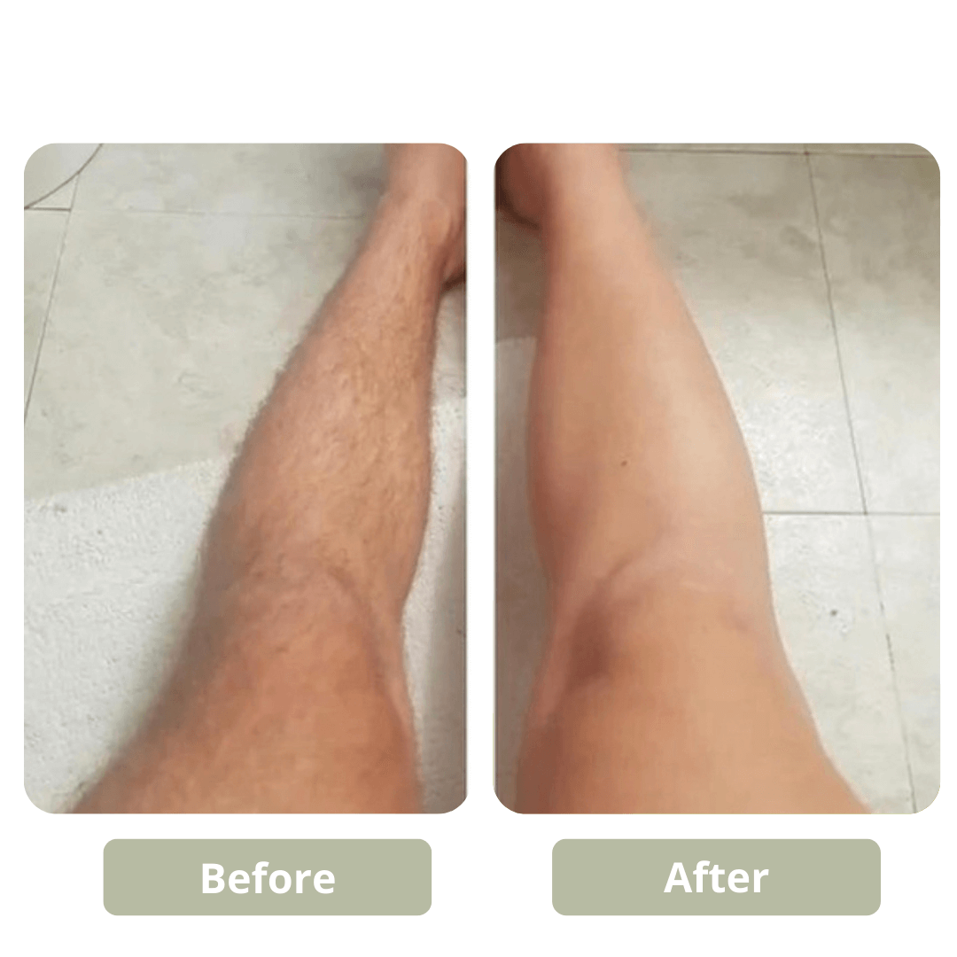 GET SMOOTH PAINLESS! - CRYSTAL HAIR ERASER