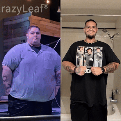 CrazyLeaf® GLP-1 Weight Loss Oral Solution – 👨‍⚕️ Supports Relief from Obesity, Cardiovascular Disease, Diabetes, Sleep Apnea, Joint Problems, and More 3