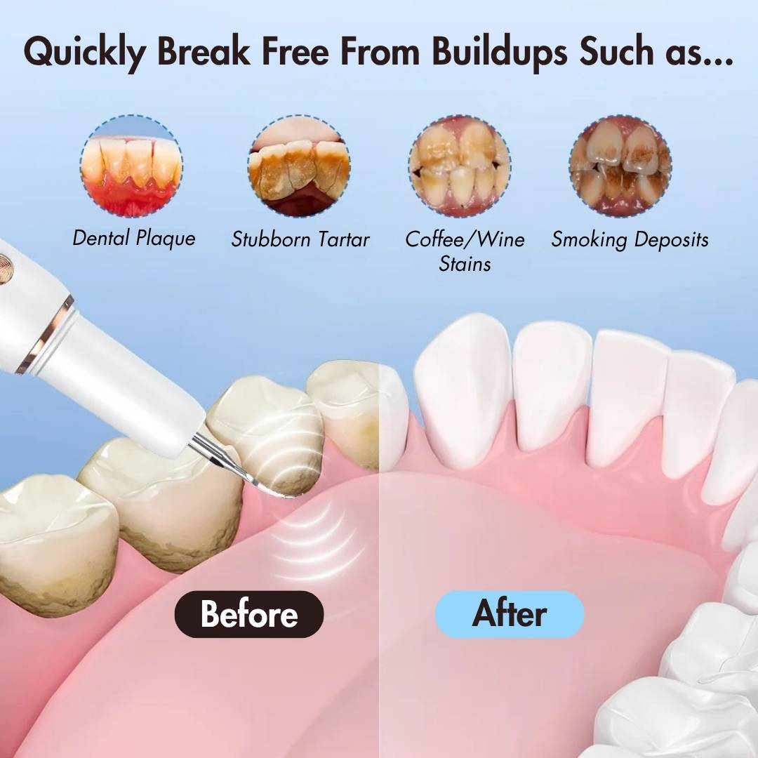 Ultrasonic Teeth Cleaner