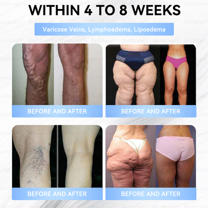 ✅FDA Store |𝐵uil𝗱𝐿ea𝐟® 𝑮𝐋𝑃-1 Slim & Firm 𝑁ano 𝑀icroneedle 𝑃atch with Collagen,Turmeric&Matrixyl 3000 丨Obesity,Cardiovascular Diseas, Diabetes, Sleep Apnea, Joint Problems and More
