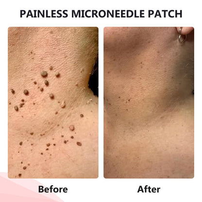 💥painless micro-patch🔥