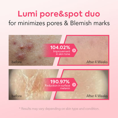 Pore & Spot Care Duo – Instantly Tightens Pores & Fades Dark Spots
