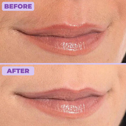 Facial Hair Removal Cream