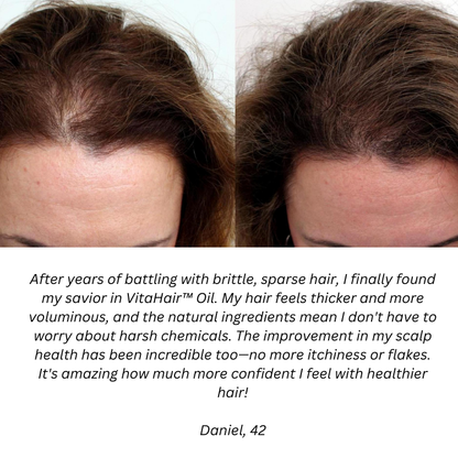 Natural Hair Growth Oil v3.0