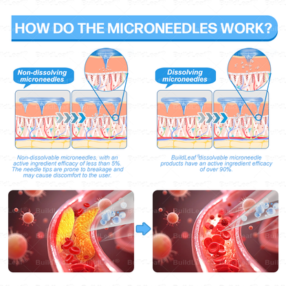 🏥FDA Official Store | 𝐵uil𝗱𝐿ea𝐟® 𝑮𝐋𝑃-1 Slim & Firm 𝑁ano 𝑀icroneedle 𝑃atch with Collagen, Turmeric & Matrixyl 3000丨Obesity, Cardiovascular Disease, Diabetes, Sleep Apnea, Joint Problems and More