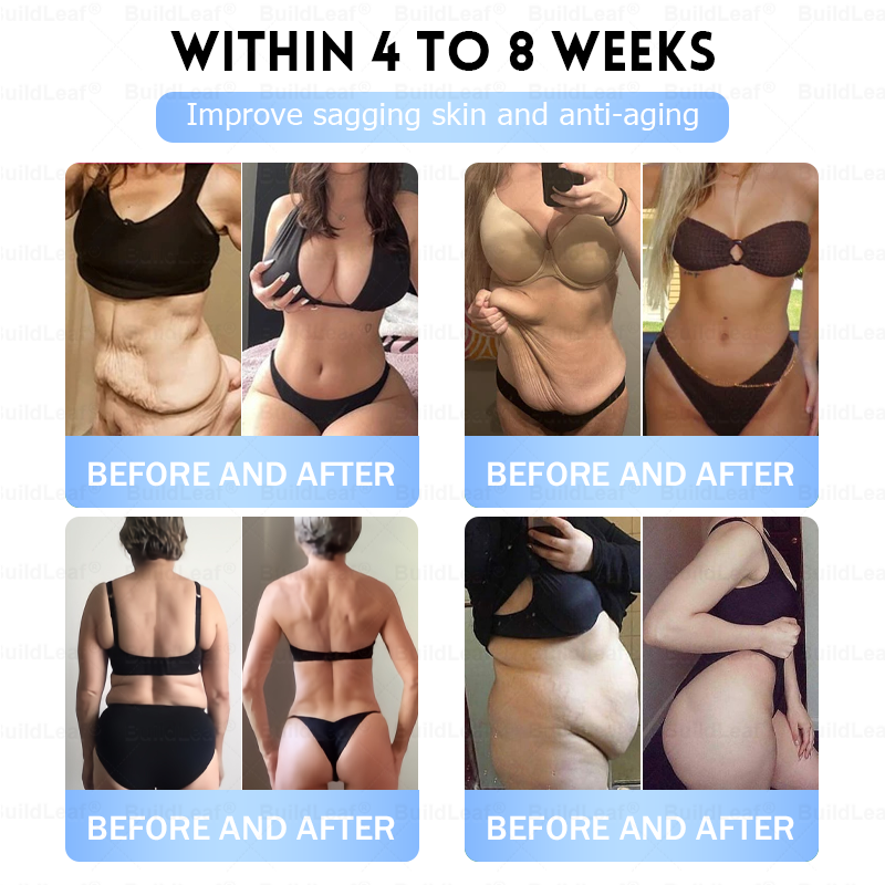 🏥FDA Official Store | 𝐵uil𝗱𝐿ea𝐟® 𝑮𝐋𝑃-1 Slim & Firm 𝑁ano 𝑀icroneedle 𝑃atch with Collagen, Turmeric & Matrixyl 3000丨Obesity, Cardiovascular Disease, Diabetes, Sleep Apnea, Joint Problems and More