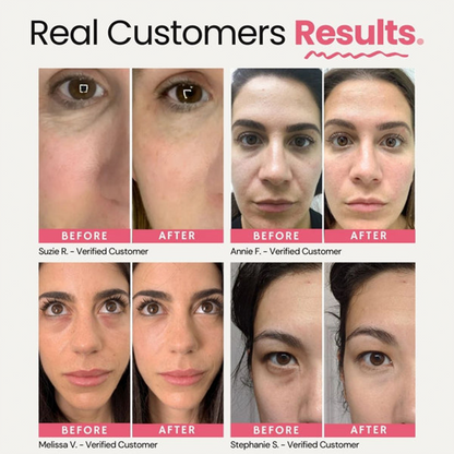 Under Eye Brightener