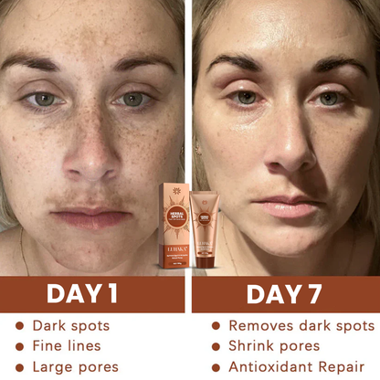 🏥FDA Official Store | Luhaka® Herbal Spots Feel-off Facial Mask