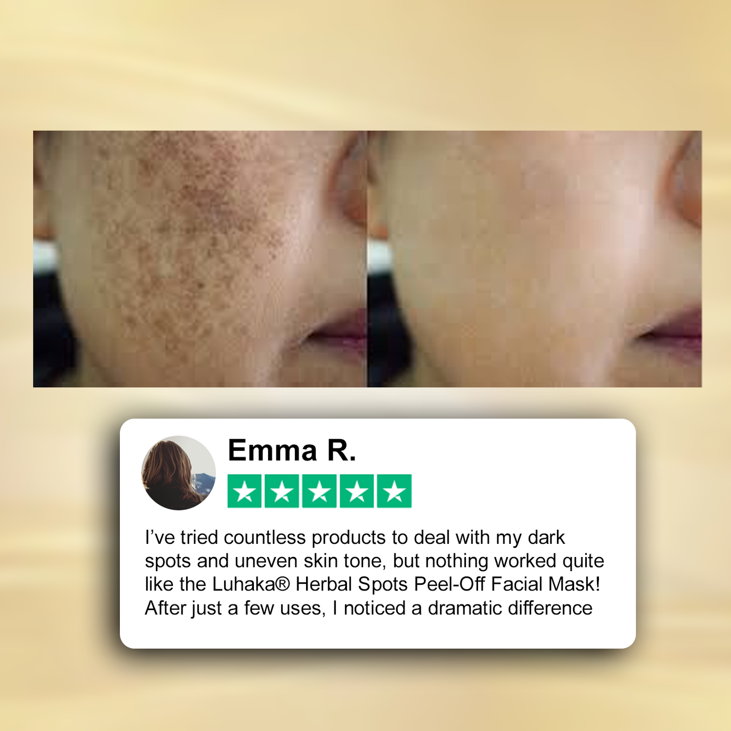 🏥FDA Official Store | Luhaka® Herbal Spots Feel-off Facial Mask