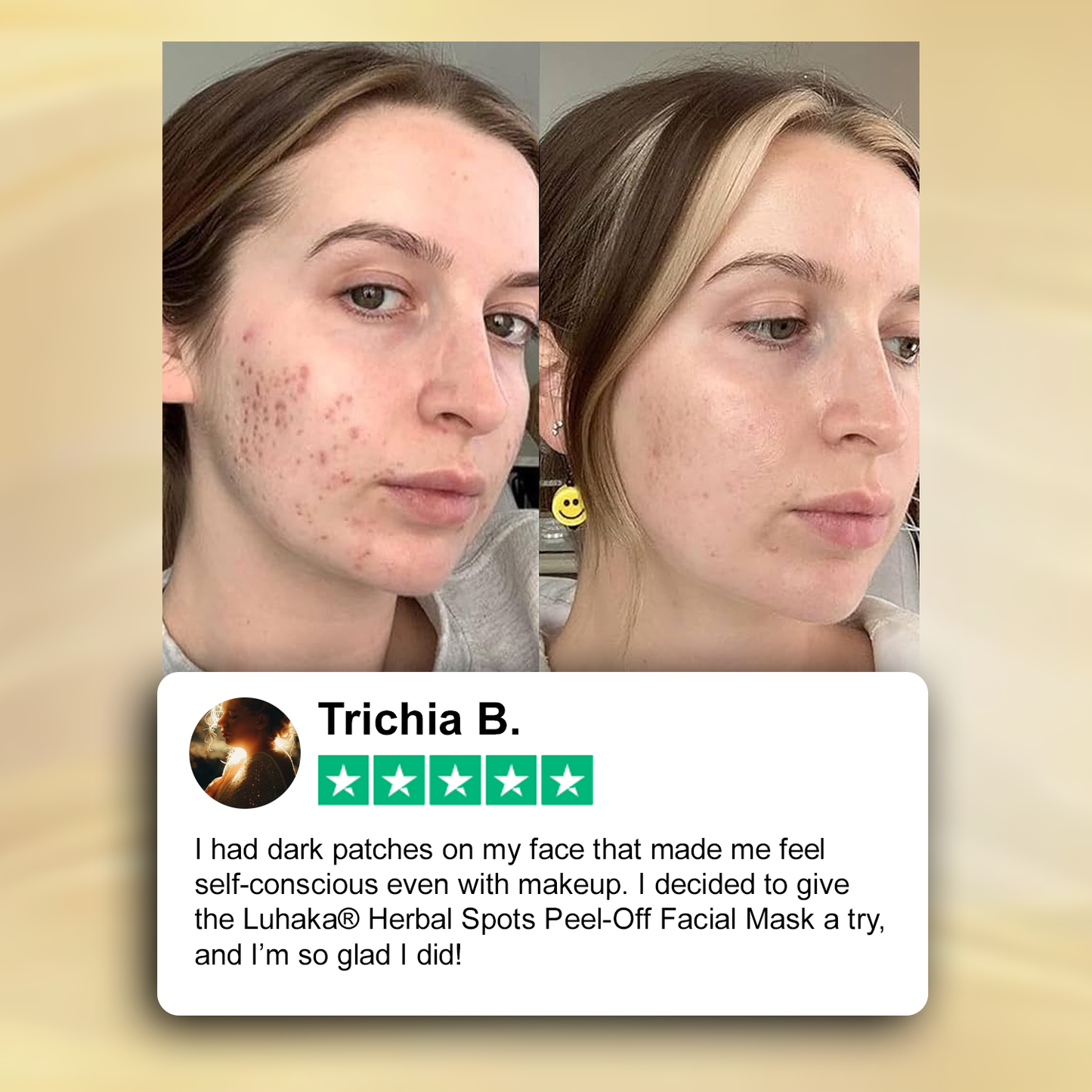 🏥FDA Official Store | Luhaka® Herbal Spots Feel-off Facial Mask