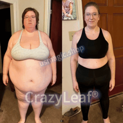Mayo & Cleveland Clinic | CrazyLeaf® Tirzepatide GIP/GLP-1 Dual-Action Slimming & Health Boost Drops (Food-grade fat burner – Developed by The Obesity Society)