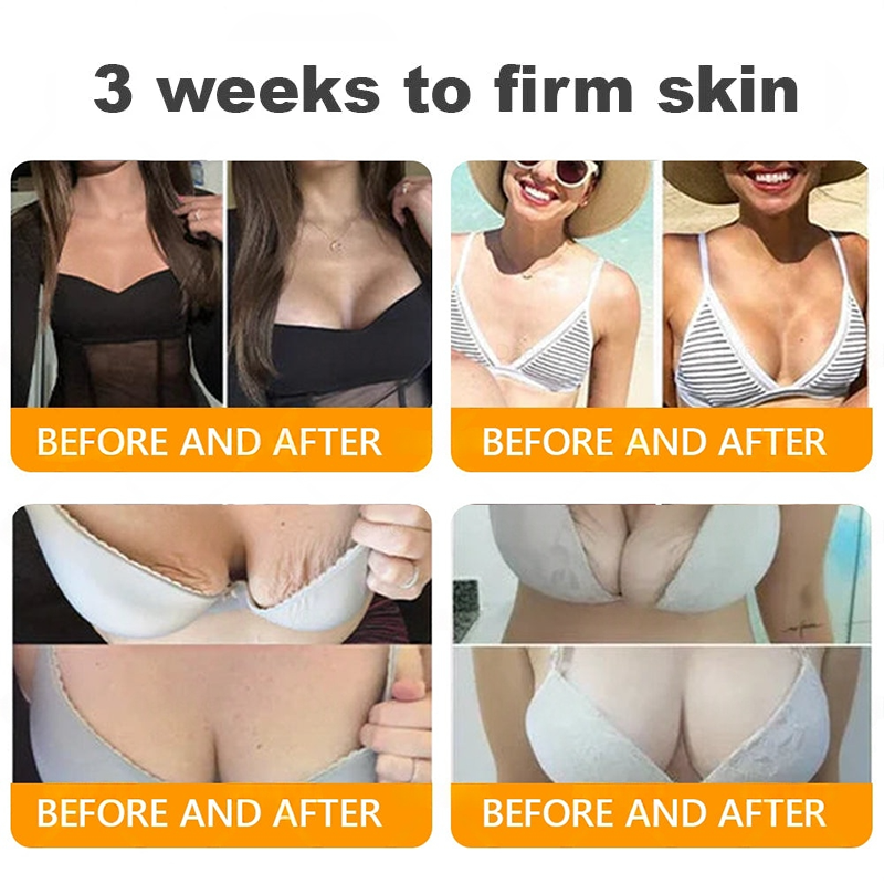✨𝐓𝐮𝐫𝐨𝐧𝐮® 𝐁𝐞𝐞 𝐕𝐞𝐧𝐨𝐦 𝐌𝐮𝐥𝐭𝐢-𝐂𝐚𝐫𝐞 𝐒𝐤𝐢𝐧 𝐑𝐞𝐩𝐚𝐢𝐫 𝐂𝐫𝐞𝐚𝐦 [See visible firming in just 7 days! ✔ Backed by our 180-day money-back guarantee🔥]