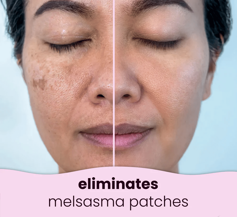 Turmeric Kojic Acid Cleansing Pads