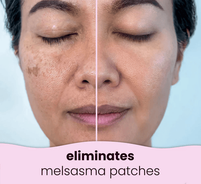 Turmeric Kojic Acid Cleansing Pads