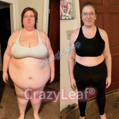 Mayo & Cleveland Clinic | CrazyLeaf® Tirzepatide GIP/GLP-1 Dual-Action Slimming & Health Boost Drops (Food-grade fat burner – Developed by The Obesity Society)