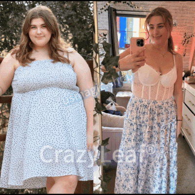 Mayo & Cleveland Clinic | CrazyLeaf® Tirzepatide GIP/GLP-1 Dual-Action Slimming & Health Boost Drops (Food-grade fat burner – Developed by The Obesity Society)
